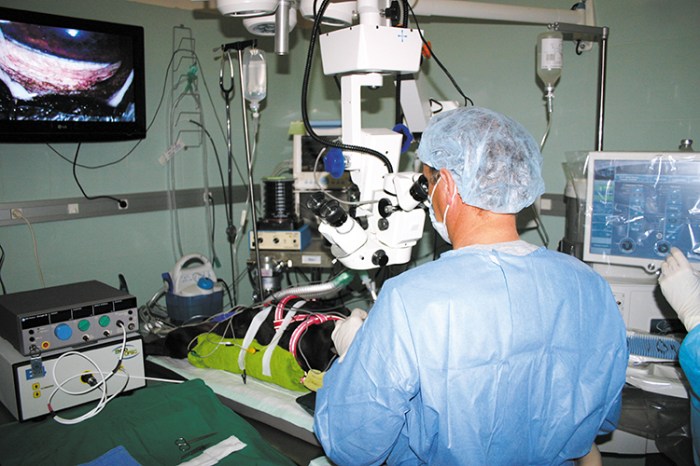 Realización de una cirugía intraocular en quirófano